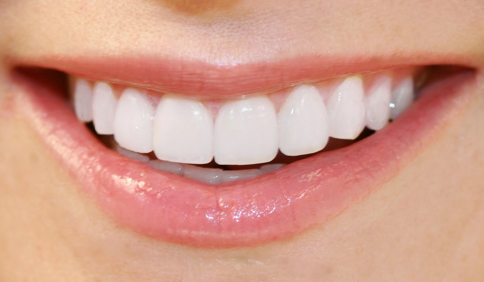 Restyling del sorriso con faccette ultrasottili