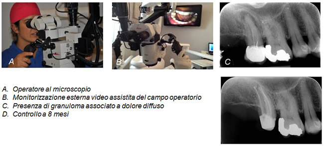 microscopio-endodonzia