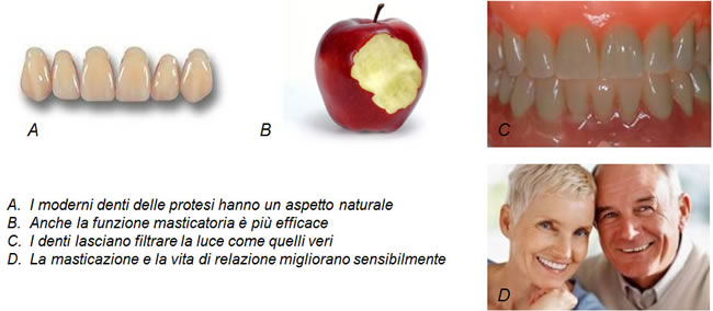 protesi-totali